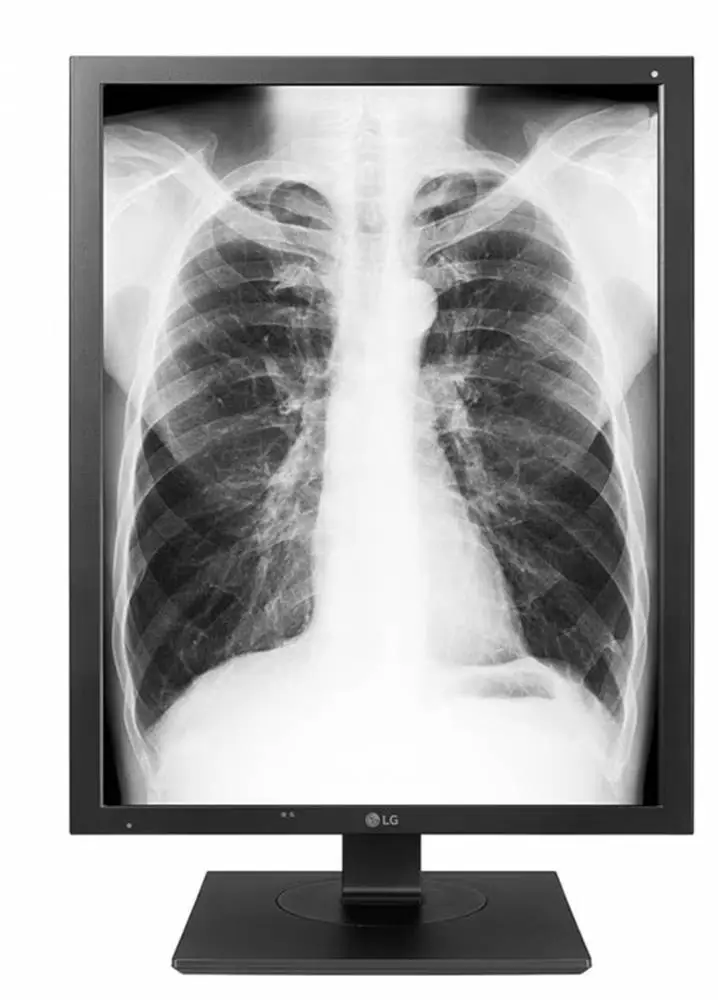 Монитор LG 21HK512D-B, 21.3", IPS, QXGA 2048x1536, 30ms, 1000cd/m2, DP, DVI-D, USB, Диагностичен монитор